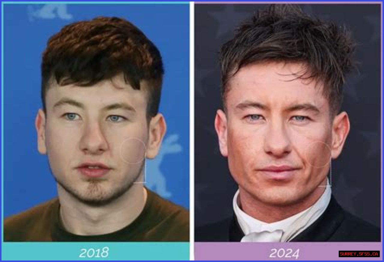 Barry Keoghan Ethnicity: Unveiling His Cultural Roots