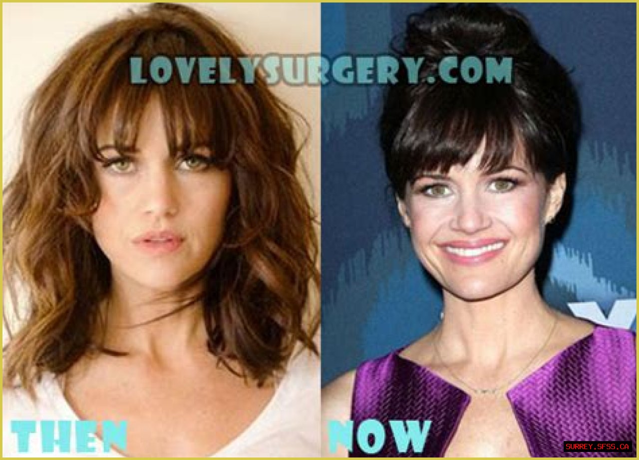 Carla Gugino Plastic Surgery Before and After
