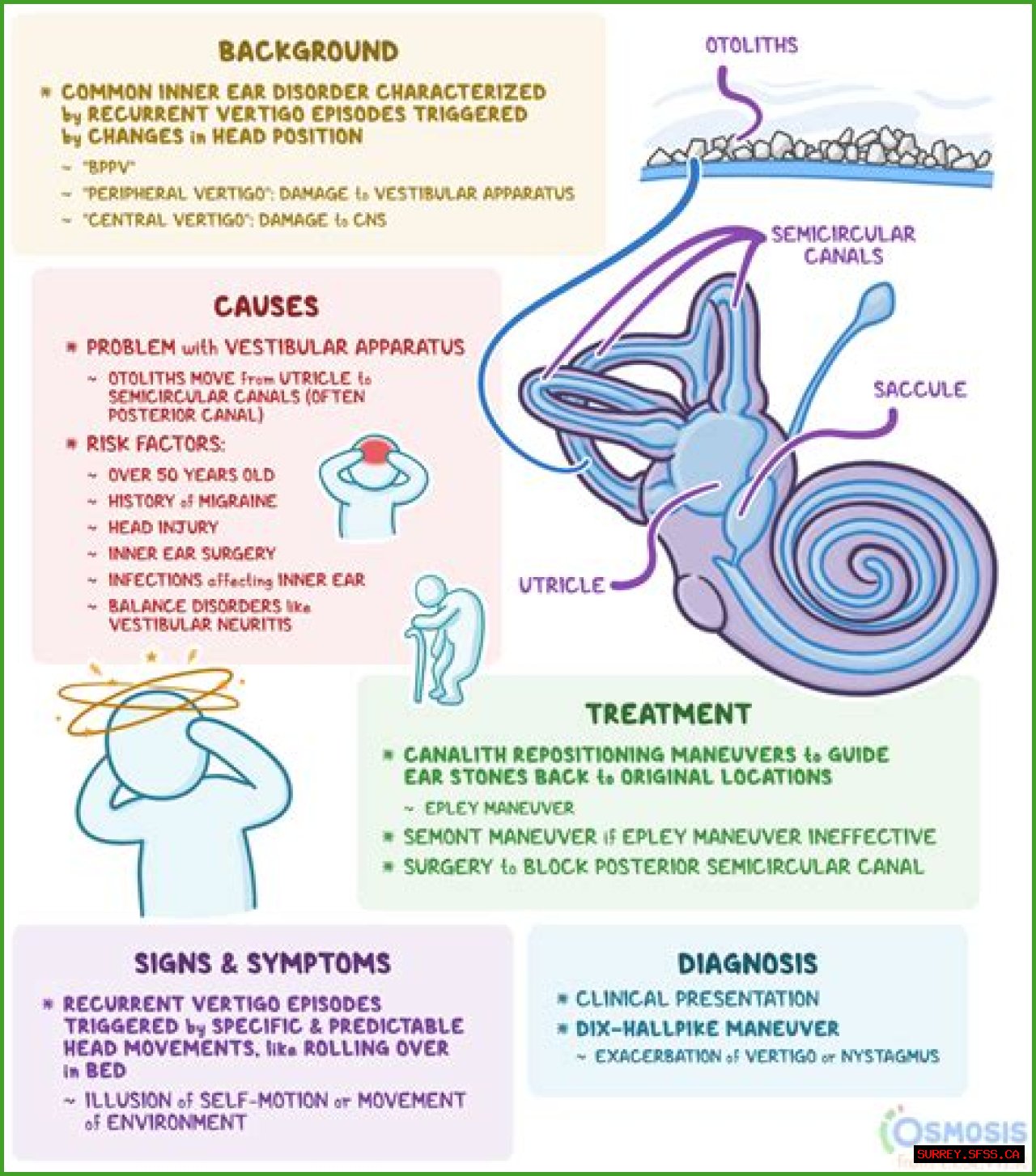 Does Flying Cause Vertigo? Uncovering The Link