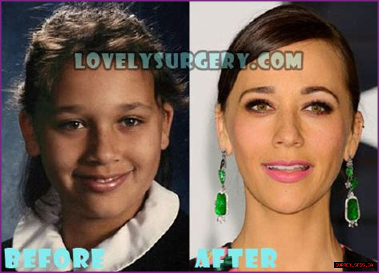Rashida Jones Plastic Surgery Before and After